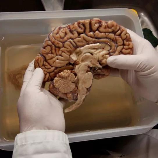 Roba un cerebro embalsamado para usar el líquido con su hierba