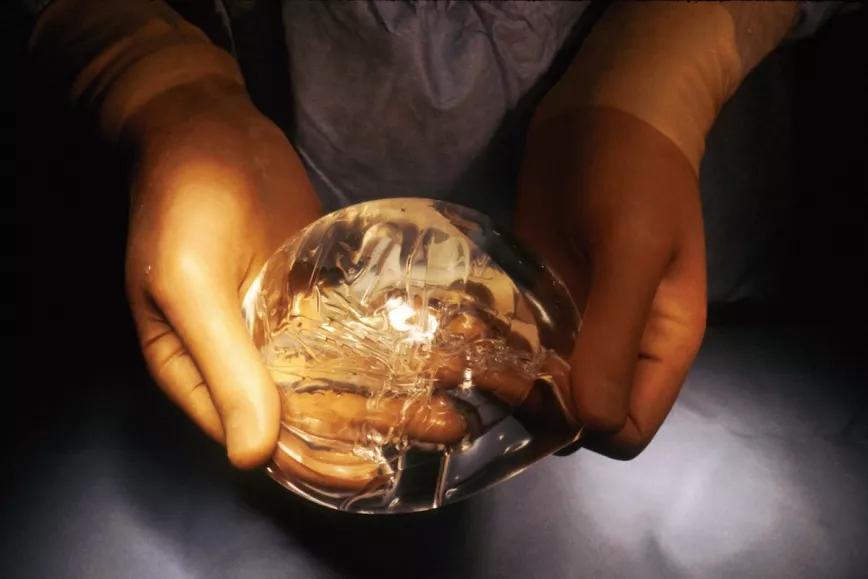 Implante de silicona para pecho femenino