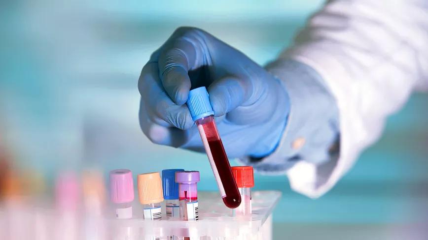 THC permanece en sangre bastante tiempo después de su consumo