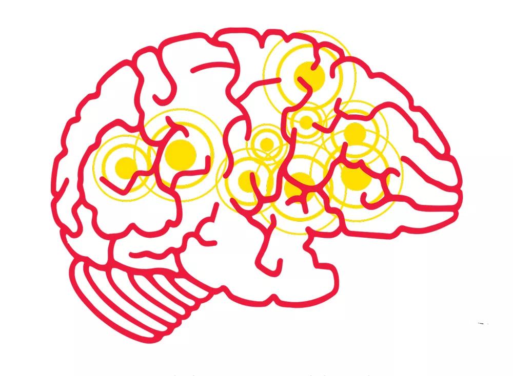 Cerebro