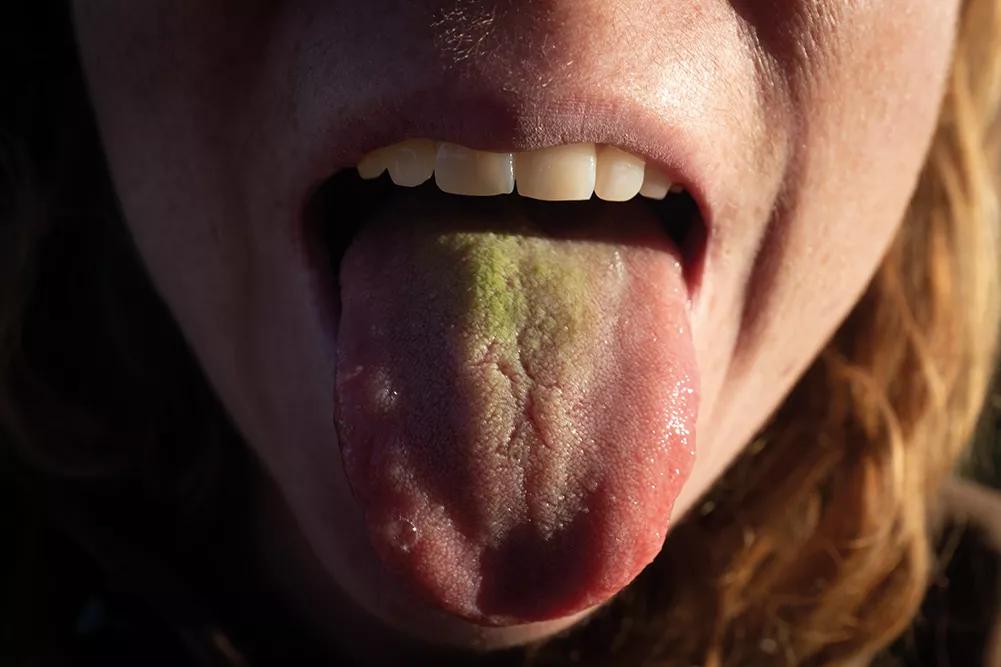 Momentos después, la lengua de Janis con visibles trazas de mescalina.